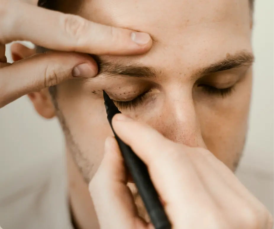 What Is a Blepharoplasty?