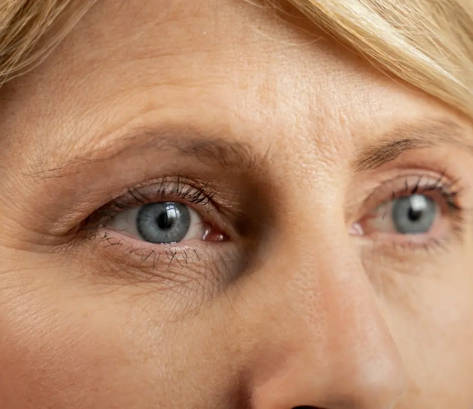 Is a browlift right for you