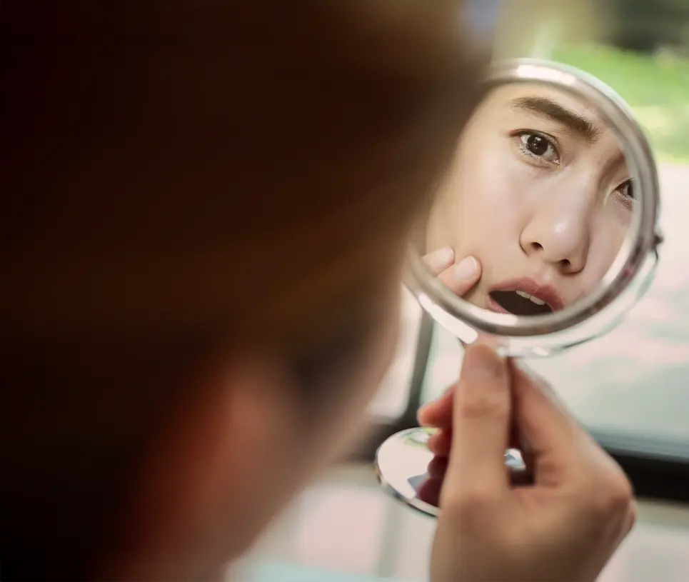 Rhinoplasty overview